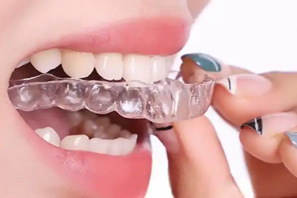 2025年牙齿矫正价格表：钢牙套与隐形牙套价格全解析