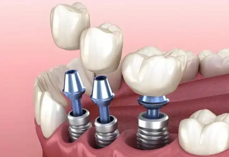 北京私立口腔医院TOP10排名：中诺、劲松、佳美位居前三