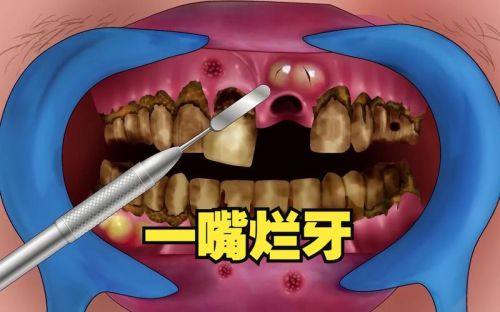 其他影响修复龋齿费用的因素