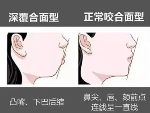 综合考量做出选择