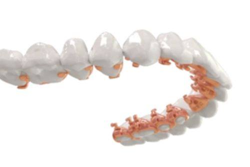 伤害产生的原因分析