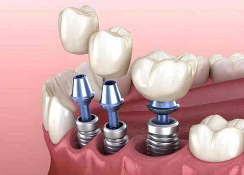 总结与行动建议