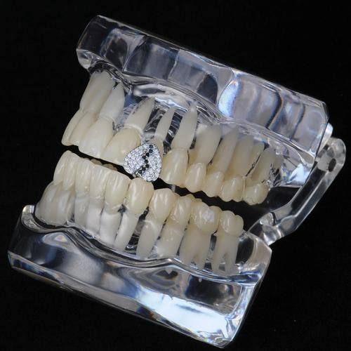 影响金属牙套佩戴时长的因素