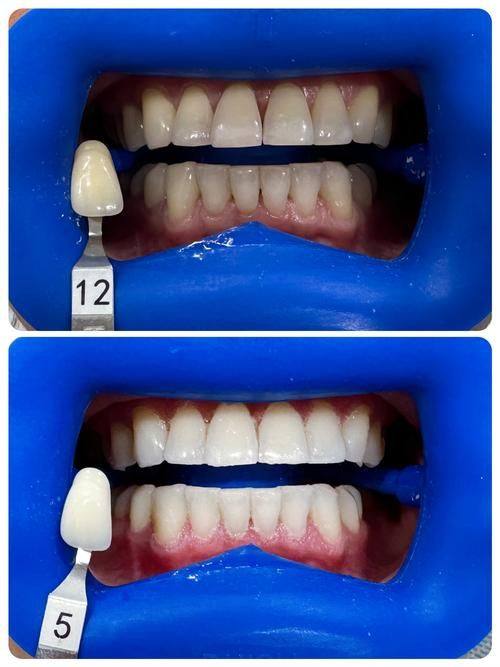 降低危害的措施