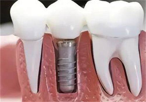 预防为主:养成良好习惯