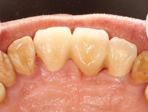 影响使用年限的因素