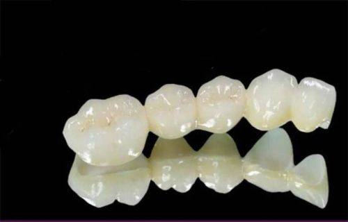 全瓷牙冠破损后的处理建议