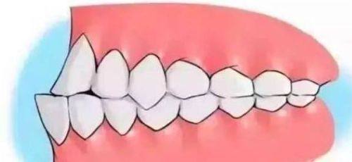 拔牙情况对费用的影响