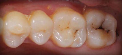 不同地区医疗保险政策差异及应对建议