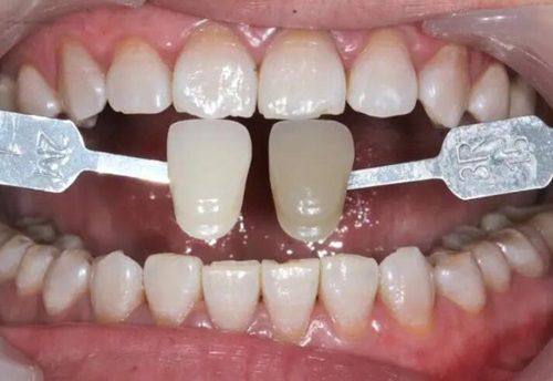 合理的收费价格