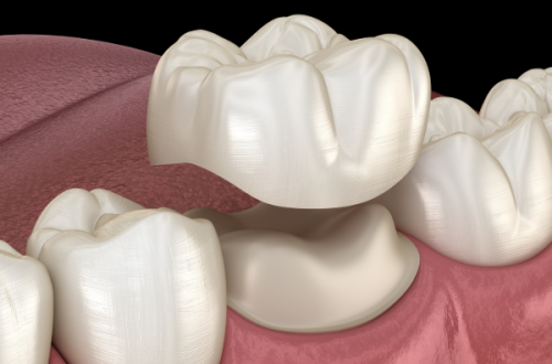 患者真实实例分享