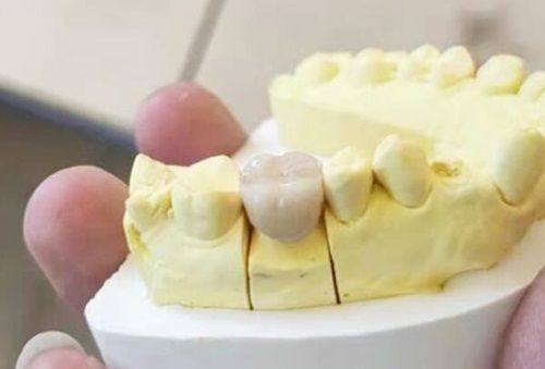 收费价格：性价比高的选择