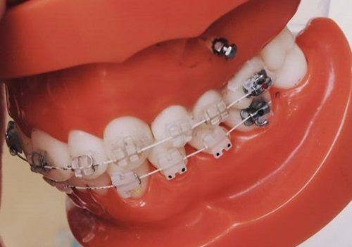 轻松预约！成都布莱梅联合口腔医院预约挂号指南与技巧