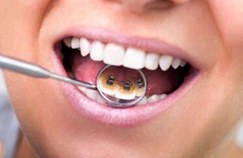 预约挂号后的注意事项