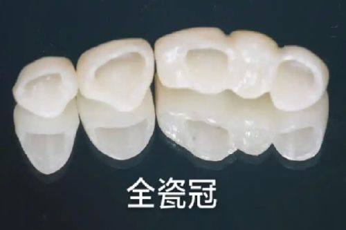 服务细节：贴心服务暖人心