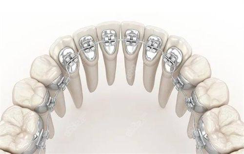 矫正原理与成效的较量