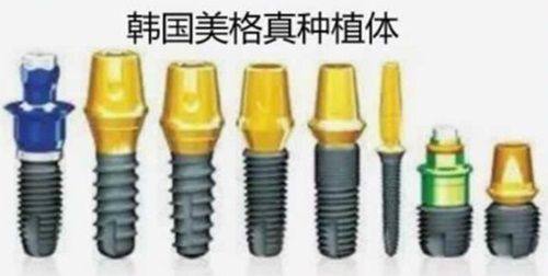 如何选择性价比高的种植牙方案