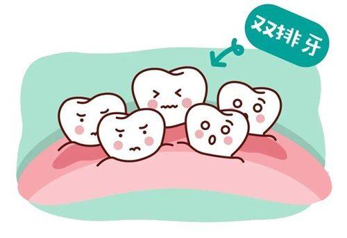 各医院种植牙技术亮点与适合人群