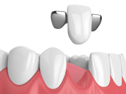 北京种植牙哪个医院比较好？2025年推荐与患者真实反馈！