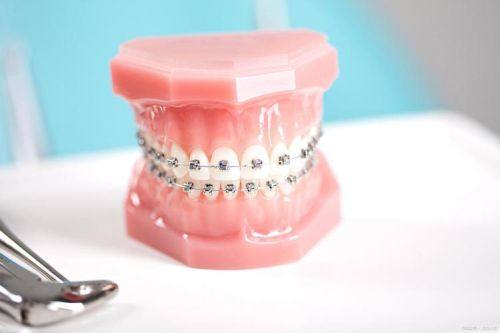 精良技术的理想结合