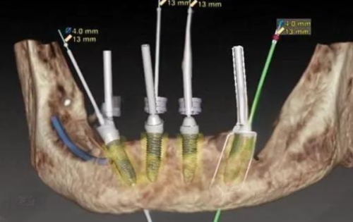 实施阶段：价格落地，逐步推进
