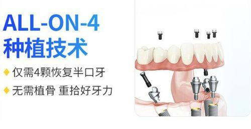 价格现状：种牙贵，贵在哪？
