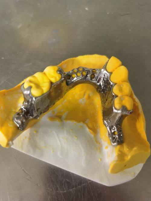 种植修复：至佳选择但价格较高