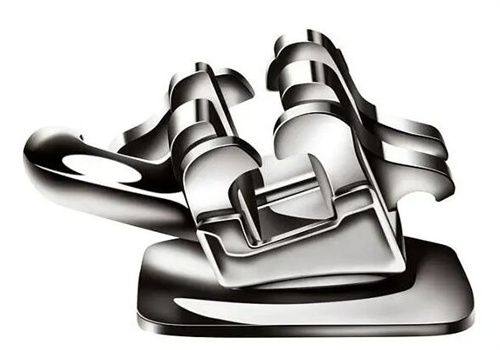 牙齿反弹后的处理建议