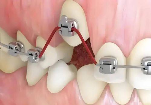 其他特殊情况需及时更换