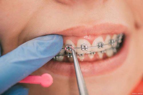 自行处理的风险