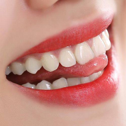 洗牙后的注意事项