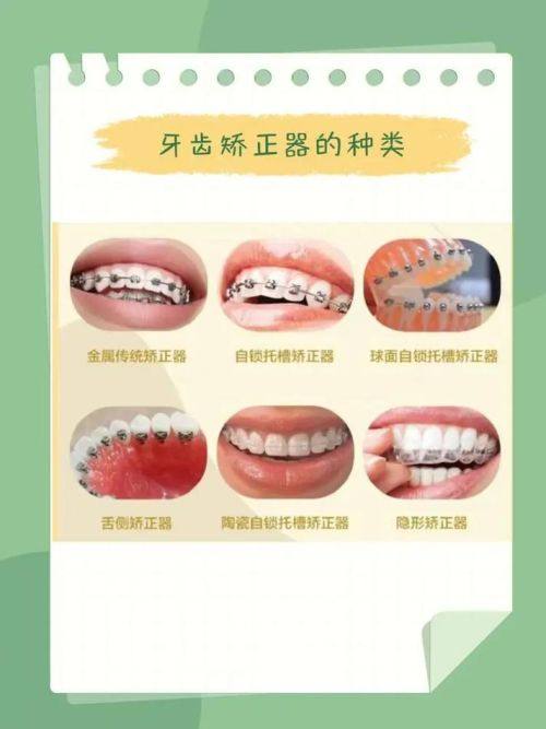 牙齿矫正至佳年龄并非完全地