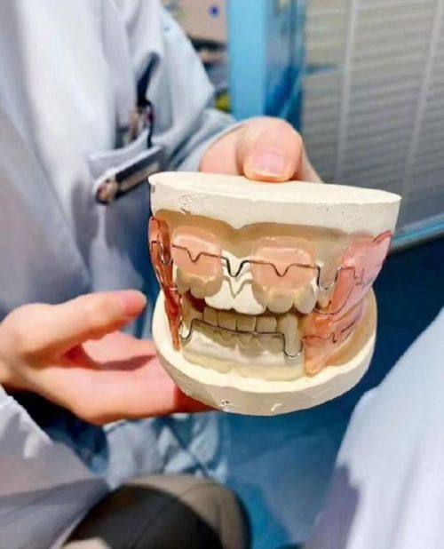 不同矫正方式收费参考