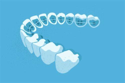 25岁矫正牙齿的注意事项