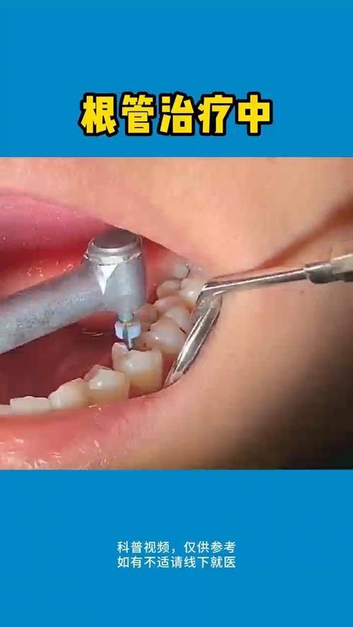 商业牙科保险报销流程