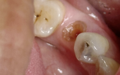 错误五：不定期复查