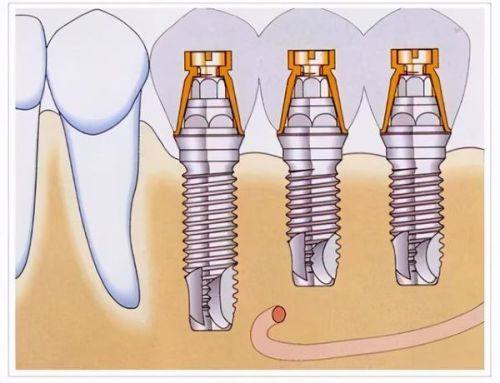 出现异常情况的处理
