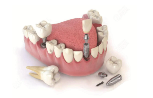 影响修复期的因素