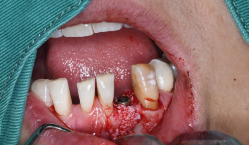 个性化饮食：遵循医生建议