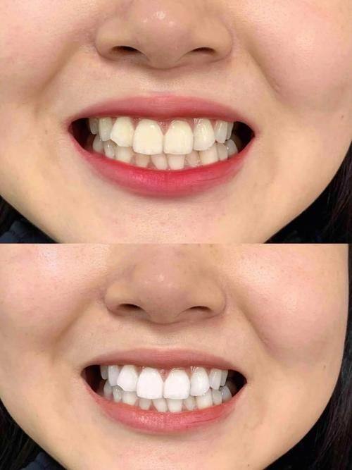 基于原理的注意事项