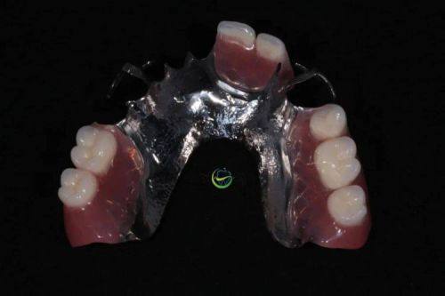 清洁方面的注意事项