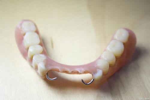 秘诀四：做好义齿清洁