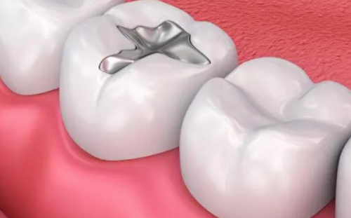 不同损坏程度的费用情况