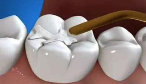 如何确认能否报销