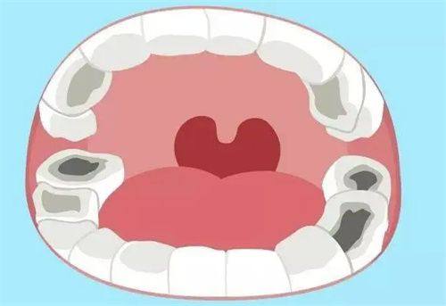 不同材料的具体区别