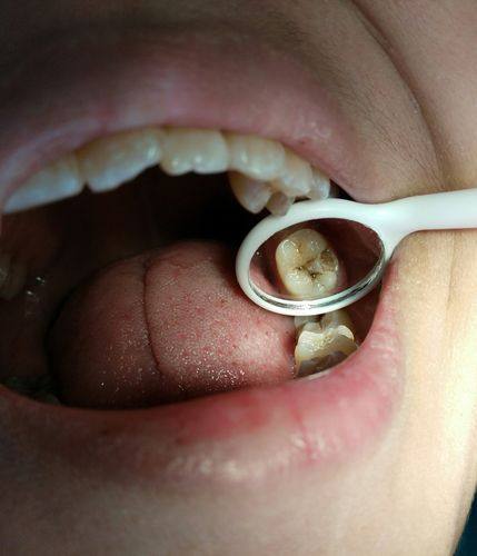 心理状态不佳的儿童