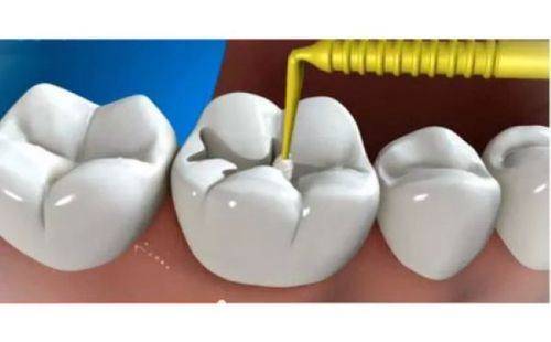 过敏史类禁忌人群