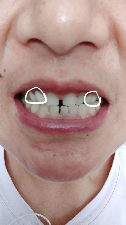 出色的耐用性能