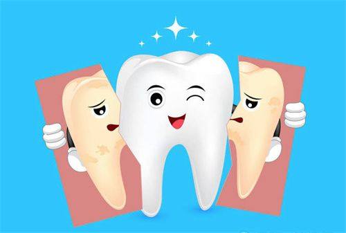 普通黄牙的美白价格