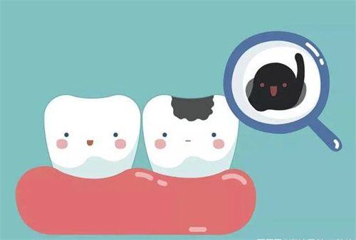 常见补牙材料及价格